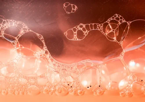 Stem Cell Therapy - A Permanent Cure For Avascular Necrosis Of Hips