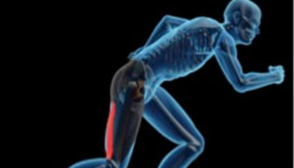 Hamstring Strain