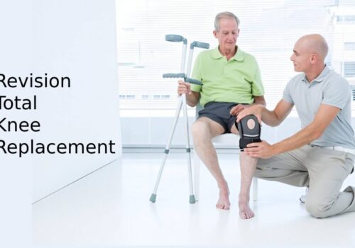 Revision Total Knee Replacement: Causes, symptoms & Recovery