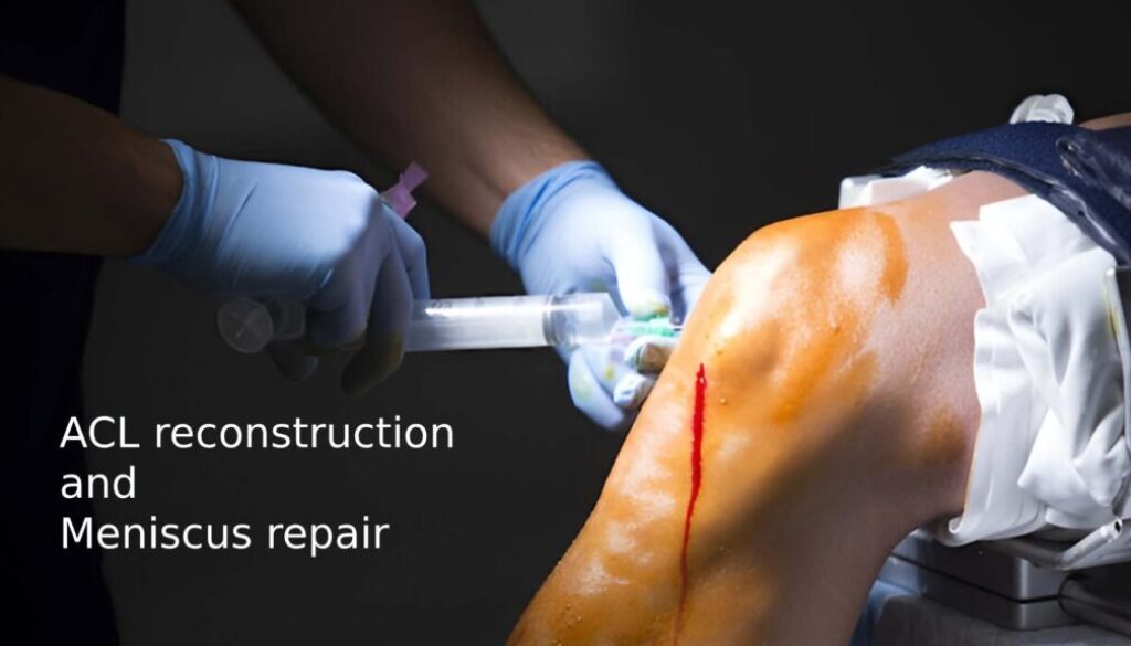 ACL reconstruction and meniscus repair